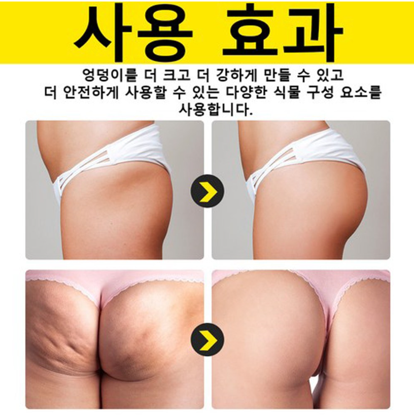 힙업크림 효과적인 엉덩이 확대 엉덩이살찌우기 엉덩이 미백