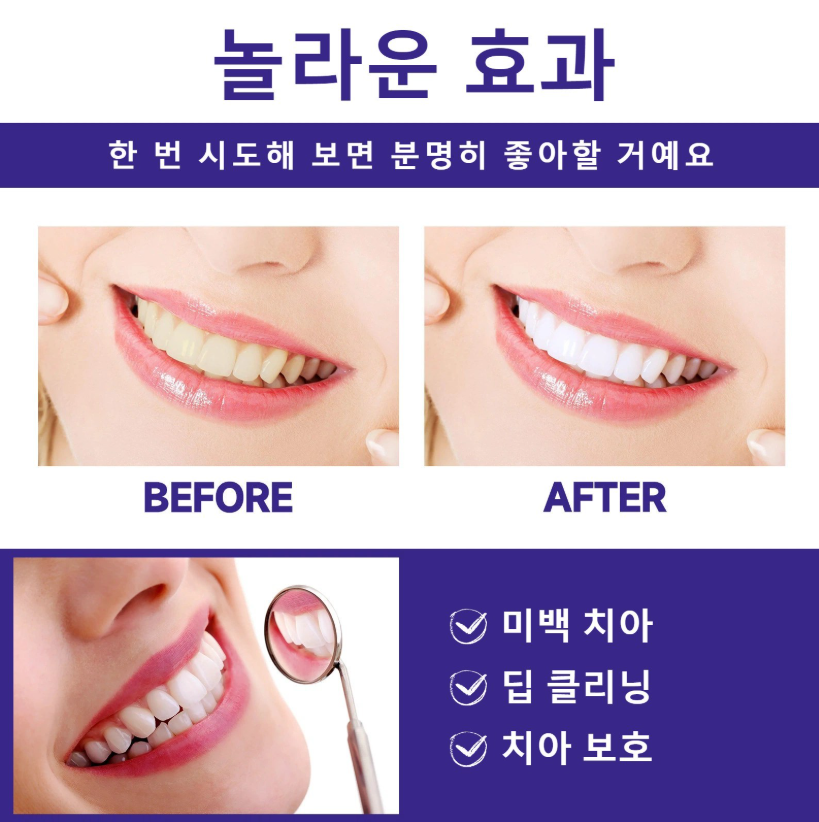 노란 치아 미백 파우더 / 강력 미백 / 치아 얼룩 케어 / 데일리 구강 케어/치아 착색 케어/휴대용치약