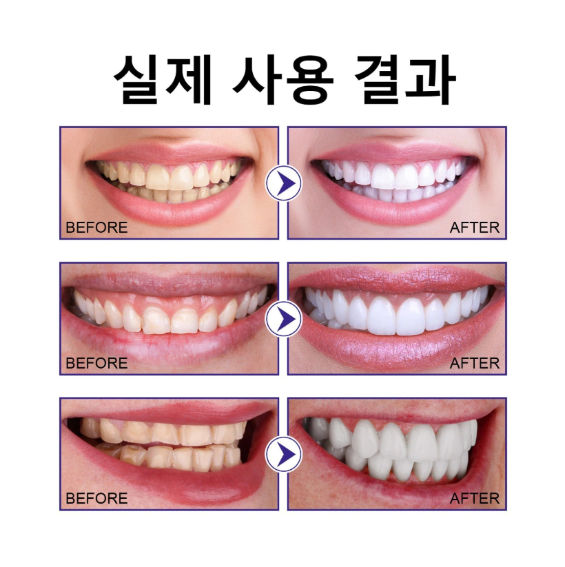 노란 치아 미백 파우더 / 강력 미백 / 치아 얼룩 케어 / 데일리 구강 케어/치아 착색 케어/휴대용치약