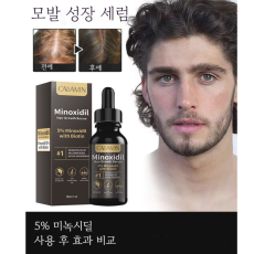 두피 케어 앰플 영양 공급 보습 집중 관리 두피 에센스 남녀공용, 30ml