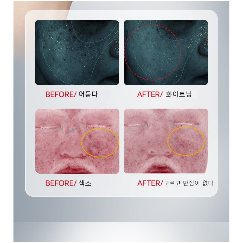 SILIYOUNG 2+1 나이아신아마이드 브라이트닝 보습 크림 알부틴 기미주근깨 칙칙함을 완화시켜주고 브라이트닝